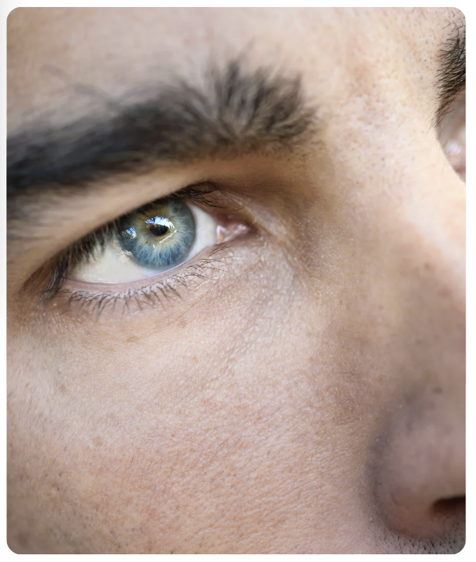 Atkinson Eye Care Prokera Treatment