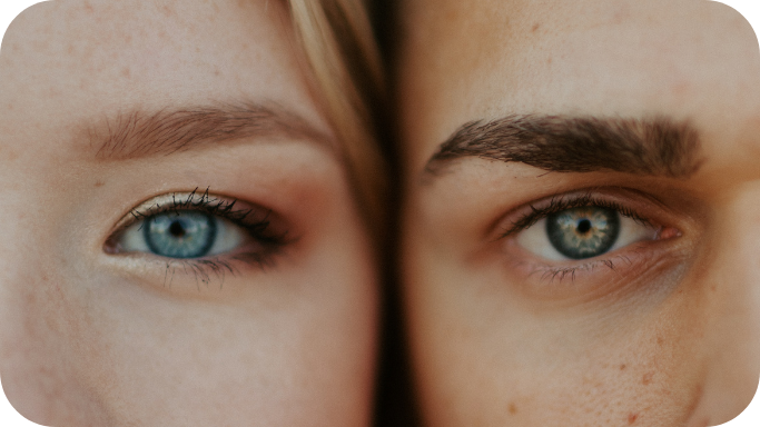 Ocular Rosacea Atkinson Eye Care Algonquin IL