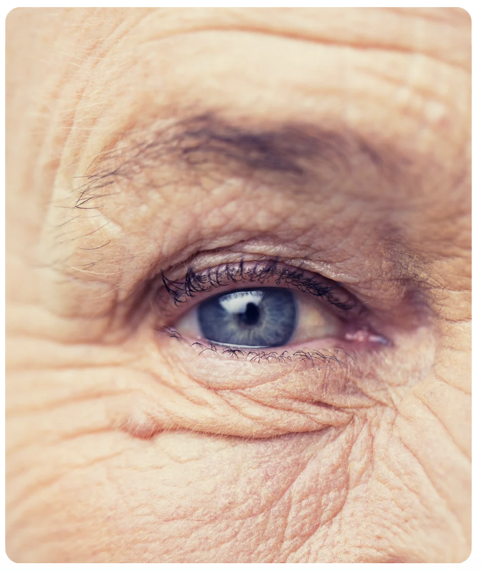 Prokera Algonquin Atkinson Eye Care