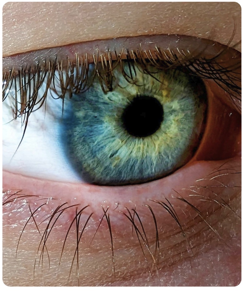 Scleral Lenses Foggy Atkinson Eye Care Algonquin Health Professional Refer